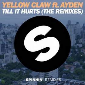 Yellow Claw - Till It Hurts [Radio Edit] (feat. Ayden)